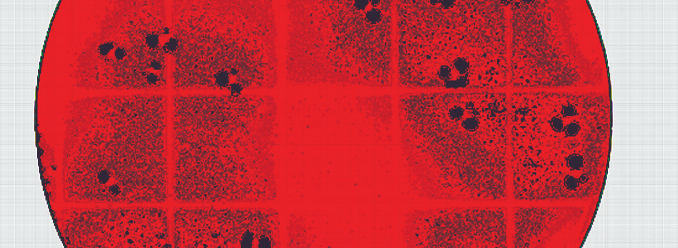 Wheel Bacteriogram Want to accelerate your workflow in the microbiology laboratory ...